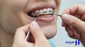 دریافت وام دندانپزشکی
