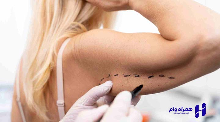 انواع جراحی زیبایی بدن
