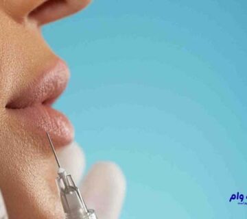 انواع جراحی زیبایی لب