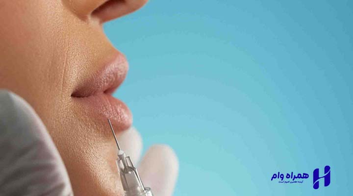 انواع جراحی زیبایی لب