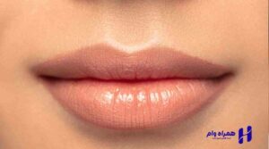 انواع جراحی زیبایی لب