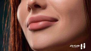 انواع جراحی زیبایی لب