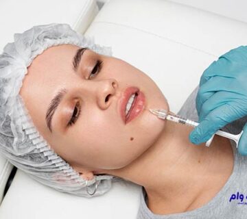 بهترین دکتر تزریق ژل در اصفهان