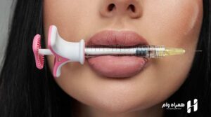 بهترین دکتر تزریق ژل در اصفهان