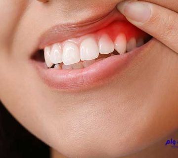 بهترین دندانپزشکان پریو کرمان