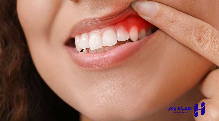 بهترین دندانپزشکان پریو کرمان