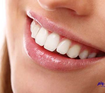 بهترین دندانپزشک ترمیمی و زیبایی قزوین