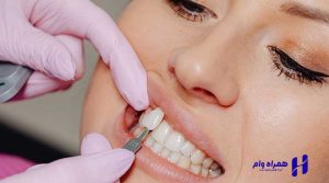 بهترین دندانپزشکان ترمیمی و زیبایی قزوین