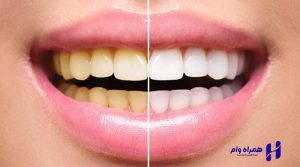 بهترین دندانپزشکان ترمیمی و زیبایی کرمانشاه