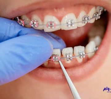 بهترین دندانپزشکان ارتودنسی اهواز