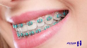 بهترین دندانپزشکان ارتودنسی اهواز