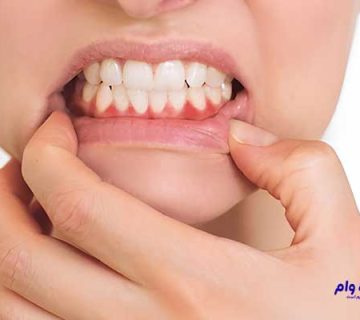 بهترین دندانپزشکان پریو قزوین