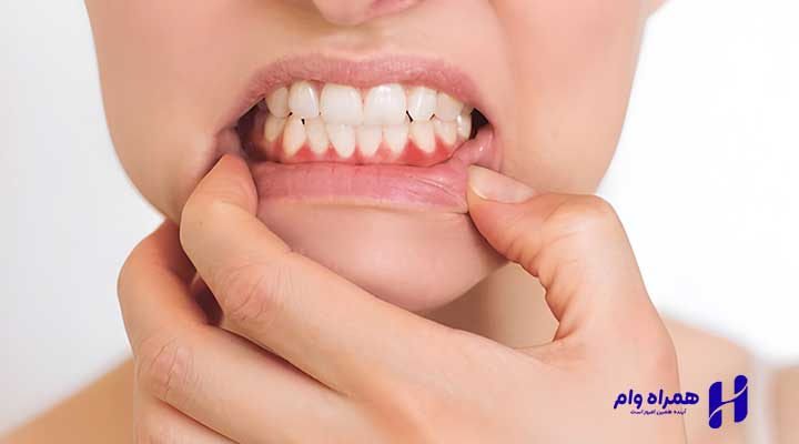 بهترین دندانپزشکان پریو قزوین