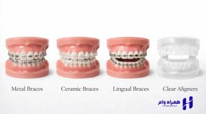 بهترین دندانپزشکان ارتودنسی کرمانشاه