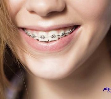 بهترین دندانپزشک ارتودنسی یزد