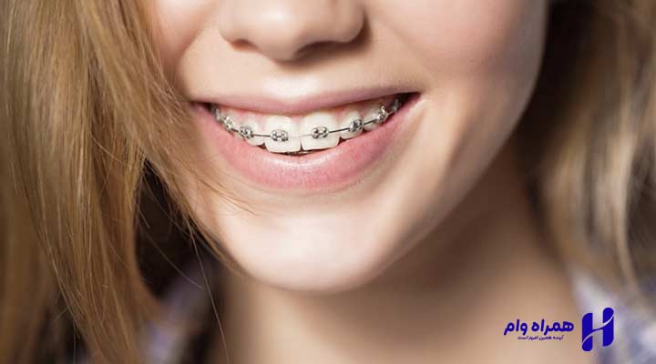 بهترین دندانپزشک ارتودنسی یزد