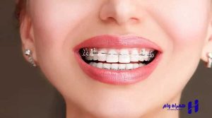 بهترین دندانپزشک ارتودنسی اصفهان